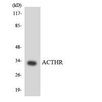 MC2-R Polyclonal Antibody