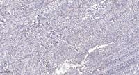 MC2-R Polyclonal Antibody