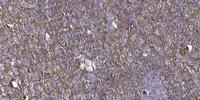 BD1L1 Polyclonal Antibody