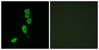 MC1-R Polyclonal Antibody