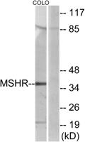 MC1-R Polyclonal Antibody
