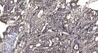 MC1-R Polyclonal Antibody
