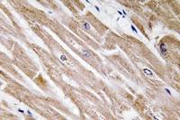 BMP-5 Polyclonal Antibody