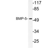 BMP-5 Polyclonal Antibody
