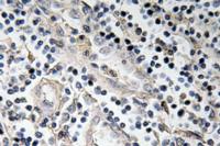 BMP-7 Polyclonal Antibody