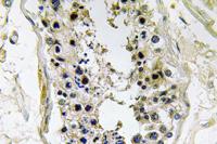 BMP-8 Polyclonal Antibody