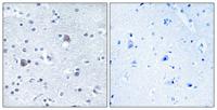 BMP-8A Polyclonal Antibody