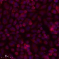 BMP-8B Polyclonal Antibody