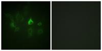 Bmx Polyclonal Antibody
