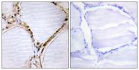 Bmx Polyclonal Antibody