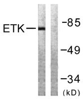 Bmx Polyclonal Antibody