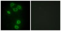 Bmx Polyclonal Antibody