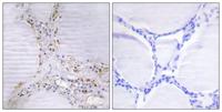 Bmx Polyclonal Antibody