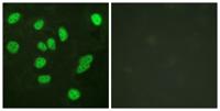 B-Myb Polyclonal Antibody