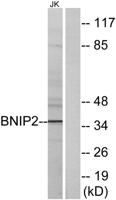 BNIP-2 Polyclonal Antibody