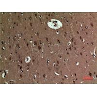BNIP-3 Polyclonal Antibody