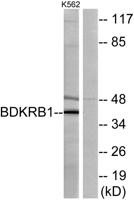 Bradykinin B1 R Polyclonal Antibody