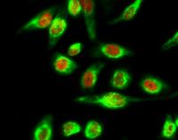 BRCA1 Polyclonal Antibody