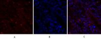 BRCA1 Polyclonal Antibody