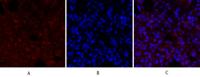 BRCA1 Polyclonal Antibody