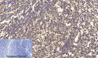 BRCA1 Polyclonal Antibody