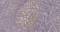 BRCA1 Polyclonal Antibody
