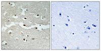 BRCA2 Polyclonal Antibody