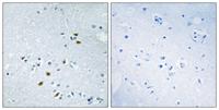 BRCA2 Polyclonal Antibody
