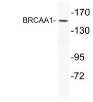 BRCAA1 Polyclonal Antibody