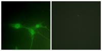 Brk Polyclonal Antibody