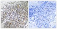 Brk Polyclonal Antibody
