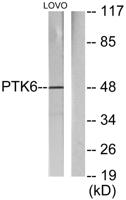 Brk Polyclonal Antibody