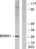 BRMS-1 Polyclonal Antibody