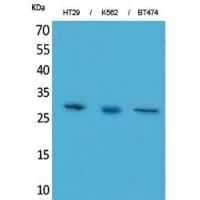 BRMS-1 Polyclonal Antibody