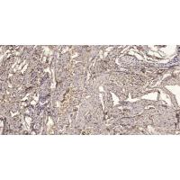 MBL-C Polyclonal Antibody