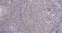 MB67 Polyclonal Antibody