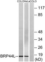 Brp44L Polyclonal Antibody