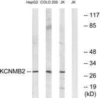 MaxiKβ2 Polyclonal Antibody