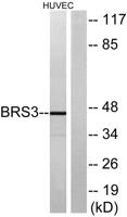 BRS-3 Polyclonal Antibody