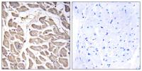BRWD3 Polyclonal Antibody