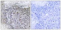 BS69 Polyclonal Antibody