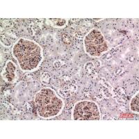 BST-2 Polyclonal Antibody