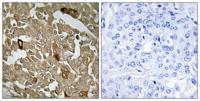 BTBD6 Polyclonal Antibody