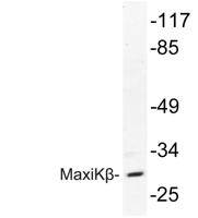 MaxiKβ Polyclonal Antibody