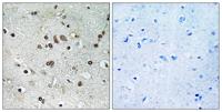 BTF3L4 Polyclonal Antibody