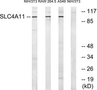 BTR1 Polyclonal Antibody