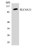 BTR1 Polyclonal Antibody