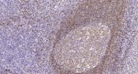 Bub3 Polyclonal Antibody