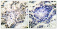 C/EBP α Polyclonal Antibody