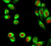 C/EBP β Polyclonal Antibody
